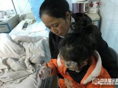 三星Note手机又爆炸 把女童炸成二级烧伤