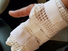 HTC旗舰手机突然爆炸严重伤人 官方沉默